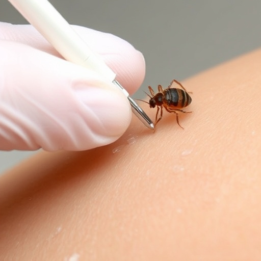 lice treatment