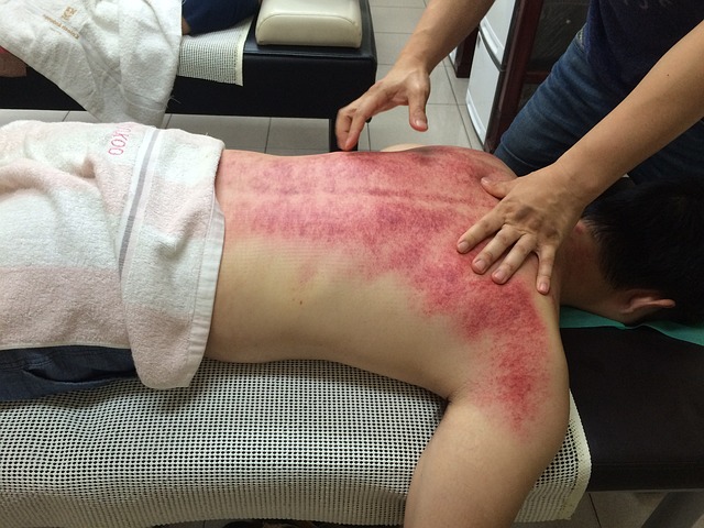 gua-sha-640x480-30623553.jpeg