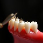 Mastering Dental Emergencies: From Burs to Post-Care Recovery