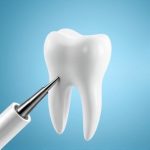 Unveiling Dental Burs: Types, Functions, and Future Innovations