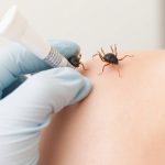 Lice Treatment Precautions: Safe Application and Post-Care Tips