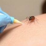 Navigating Online Resources for Effective Lice Treatment Products