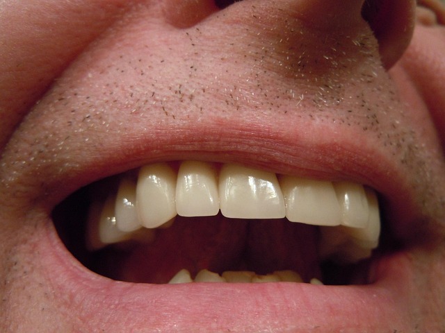dental-burs-640x480-23230891.jpeg