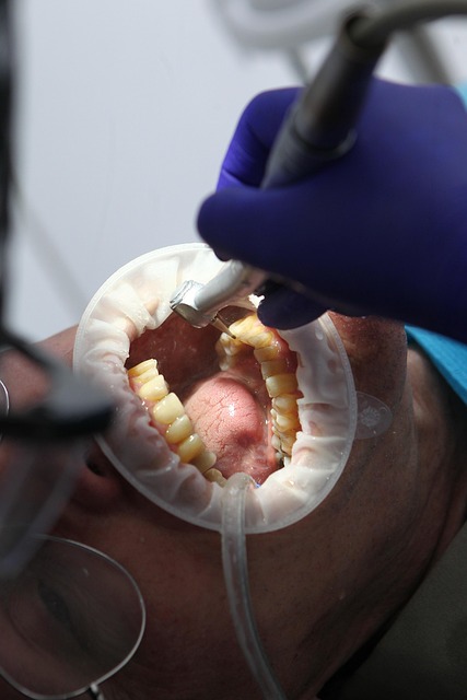 dental burs