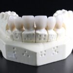 Steel Quality for Dental Burs: Strength and Performance