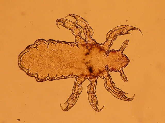 lice treatment