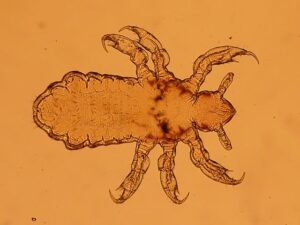lice-treatment-640x480-55421731.jpeg