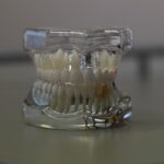 Master Dental Burs Safety: Comprehensive Risk Management