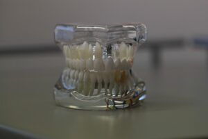 dental-burs-640x480-90692883.jpeg