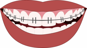 dental-burs-640x480-43378909.png