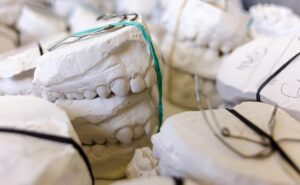 dental-burs-640x480-52326160.jpeg