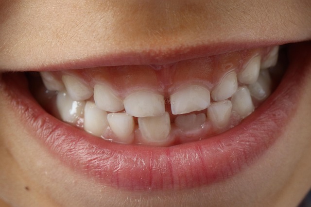 dental-burs-640x480-47630129.jpeg