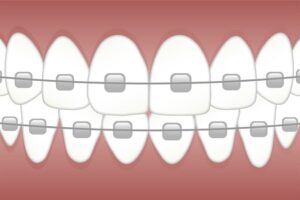 dental-burs-640x480-58461374.jpeg