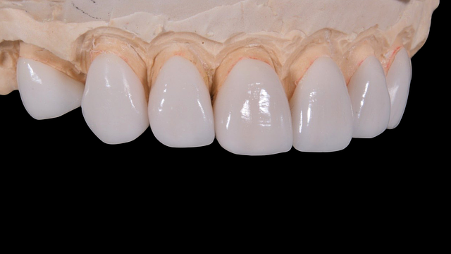 dental burs